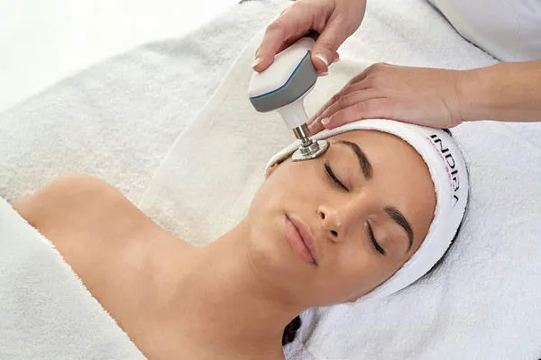 Indiba Facial: Un Avance Innovador en la Medicina Estética Europea