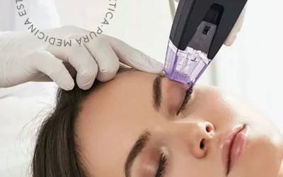 Innovación en Estética: Coolsculpting y Morpheus 8 en el EuroEM Conference